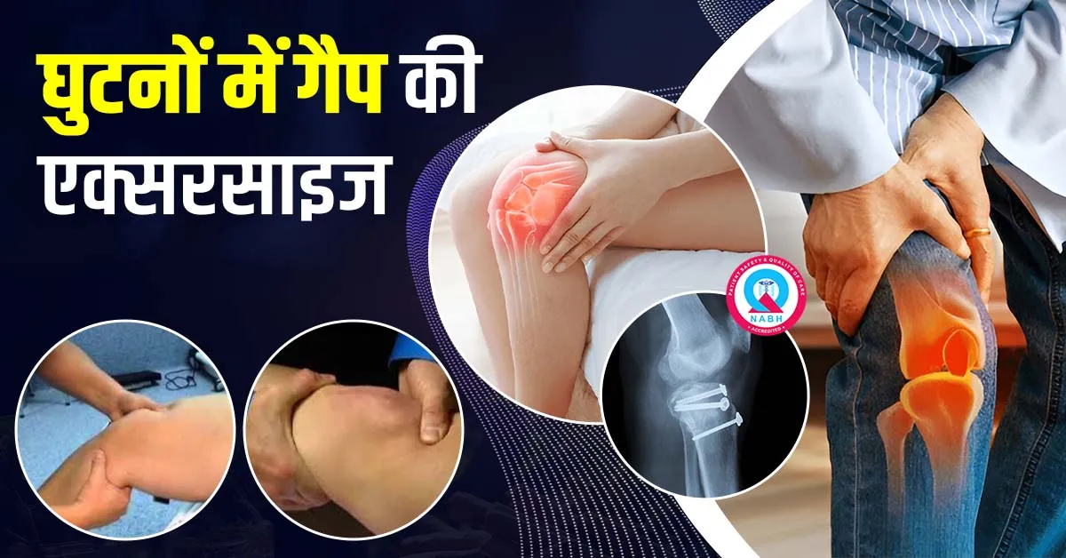 घुटनों-में-गैप-की-एक्सरसाइज